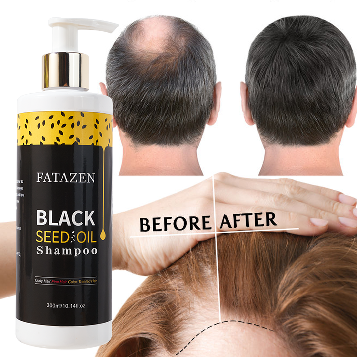 Wholesale Organic Rich Care Hair Regrowth Shampoo Anti-Hair Loss Conditioner Natural Black Seed Oil Essence Hair Shampoo